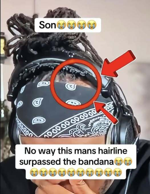 way this mans hairline surpassed the bandanaEUR