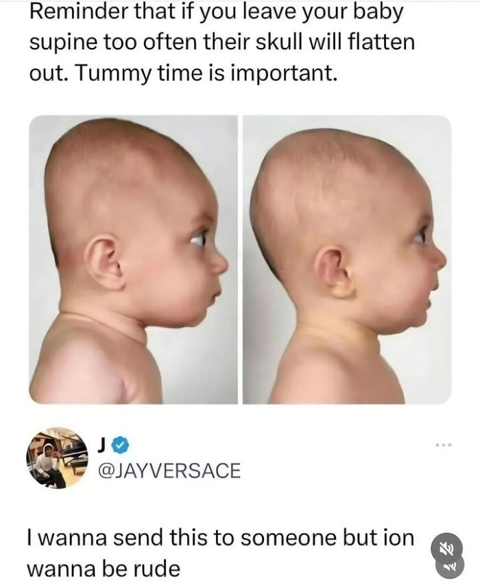 Reminder that if you leave your baby supine too often their skull will flatten out. Tummy time is important.