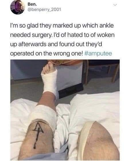 glad they marked up which ankle needed surgery. I'd of hated to woken afterwards and found out they'd operated on the wrong one! #amputee